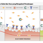 Gambar 2. Reaksi Endotoksin pada usus sehat dan usus yang mengalami peradangan. Dapat dilihat bahwa pada usus yang mengalami peradangan, gut barrier atau pertahanan usus terganggu.